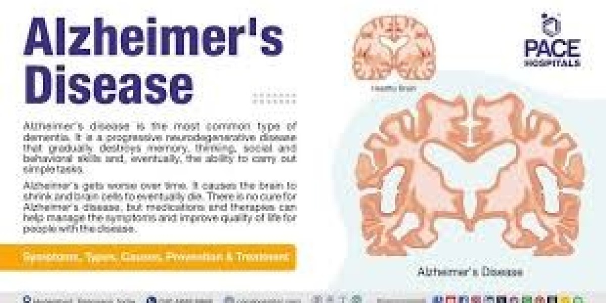 Article Picture